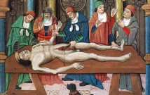 Dissection of a Cadaver